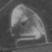 1990 Arial of the abandoned Drive In  